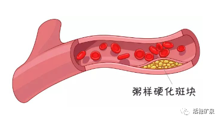 健康谈丨血管洗个澡，血管干净“百岁不老”~