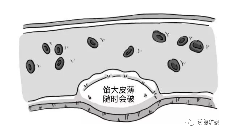 健康谈丨血管洗个澡，血管干净“百岁不老”~