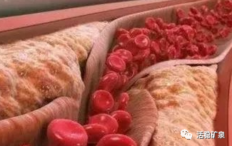 健康谈丨血管洗个澡，血管干净“百岁不老”~
