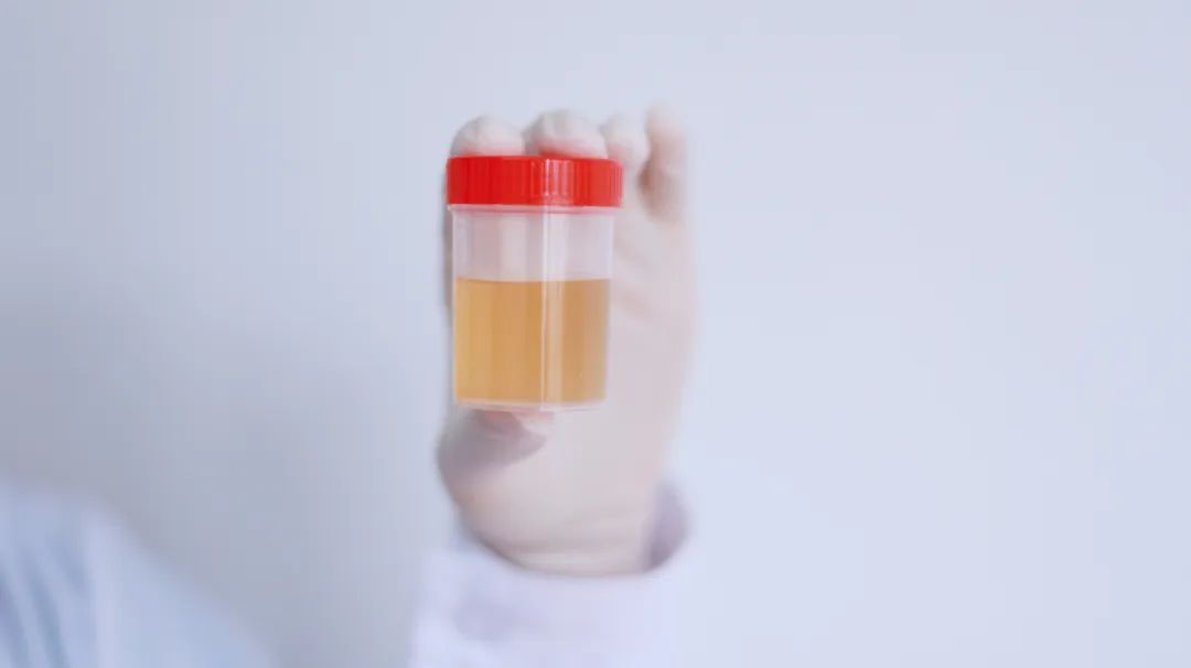 排尿很黄、尿味很大？多是这3个原因引起，为了健康，需警惕！【每天一个冷知识系列（21）】